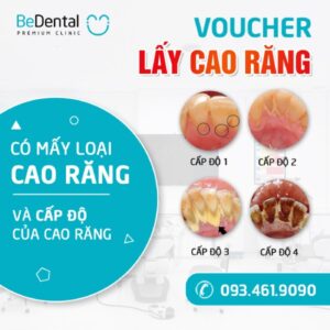 In Hoa Long nhận in voucher nha khoa chất lượng