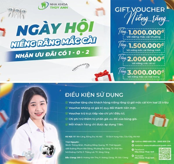 In Hoa Long nhận thiết kế và in ấn mẫu voucher niềng răng chuyên nghiệp