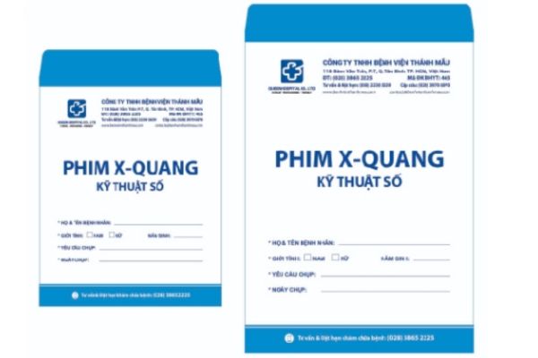 Túi giấy đựng phim x quang theo yêu cầu