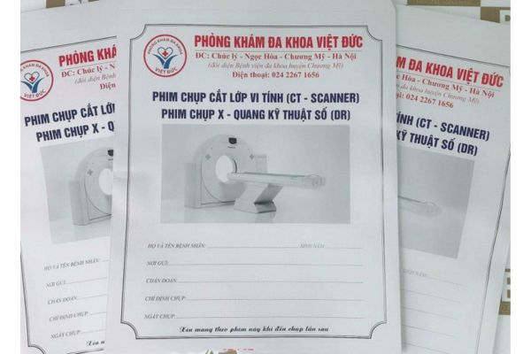 Túi giấy đựng phim x quang theo yêu cầu